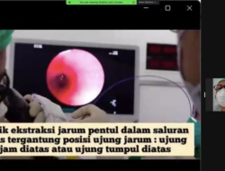 Detik-detik Dokter Senior FKUI Keluarkan Jarum Pentul dari Lambung